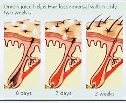 Garlic juice and honey for hair growth Onion Garlic Growth Oil Scrubtiousinc