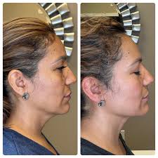 Desert Functional Medicine & Aesthetics