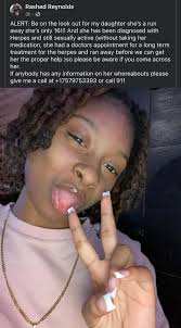 Parent's Post About Runaway Daughter with Herpes
