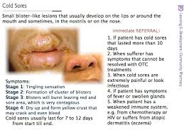 Check spelling or type a new query. E Pharmacy Academy Cold Sores Definition Of Condition Some Blister Like Lesions That Usually Occur On The Edge Of The Lips Cause Caused By The Herpes Simplex Virus Hsv Cold Sores Are Mostly