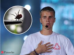 Lyme Disease What Is Lyme Disease Its Symptoms Causes And Treatment Read All About It