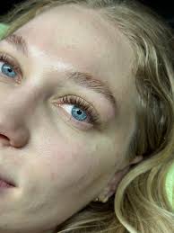 could you all give my aesthetic page a follow please. i will be following  back. i will be posting my journey in the next week!!💓💉