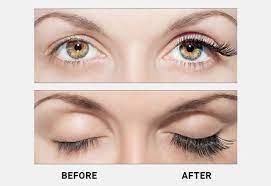 This is how latisse makes your lashes grow longer. Latisse Eyelash Growth Treatment In Fresno Madera Ca