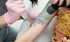 We specialize in removing tattoos of all sizes and colors. Laseraway From 129 Groupon