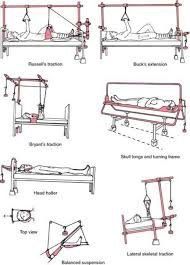 Types Of Traction Google Search Orthopedic Nursing Pediatric Nursing Nurse