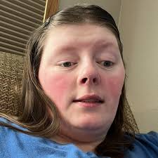 In case anyone missed this