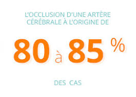 Flashcards in chapitre 2 suite : Accident Vasculaire Cerebral Avc Inserm La Science Pour La Sante