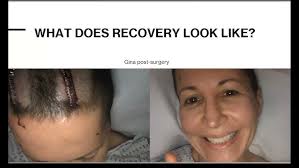 PD Warrior Presentation With Ben & Alfonso