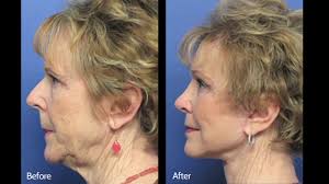 Welcome to Beverly Hills Body