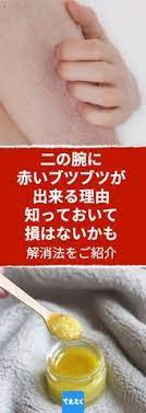 二の腕の赤いブツブツの出来るワケ 知っておいて損はないかも ちえとく diy ビューティー ビューティーアドバイス