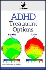 People with add/adhd can get a treatment plan that is personalized for their individual needs. Adhd Treatment Options Sinha Clinic Find Your Focus