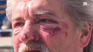 Grenchen SO: Vater mit Tochter im Rollstuhl am helllichten Tag brutal  überfallen