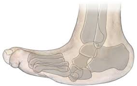 Die neuroosteoarthropathie (noap) von fuß und sprunggelenk wird durch ossäre destruktionen reconstructive surgery of charcot feet using external fixation is a safe and economically feasible. Behandlung Von Fusswurzelinstabilitaten Bei Charcot Fuss Mit Dem Ringfixateur Springerlink