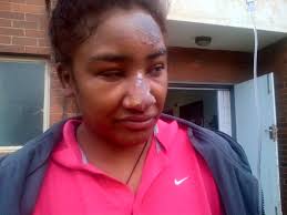 Justice for Naadiya Stofberg and All who have been brutality attacked