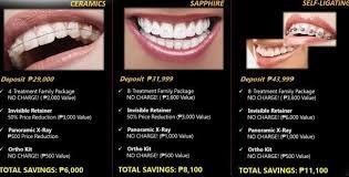 How Much Do Braces Cost In The Philippines Braces Cost How Much Braces Cost Orthodontics