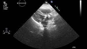 In The Utero An Infant Stock Footage Video 100 Royalty Free 9228377 Shutterstock
