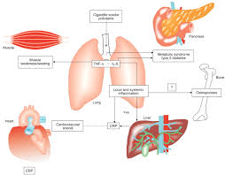 Nurses care for patients with copd across the spectrum of care, from outpatient to home care to emergency department, critical care, and hospice. Complex Chronic Comorbidities Of Copd European Respiratory Society