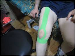 Whether you're new to kenesiology wondering how to apply kt tape for knee, shoulder, wrist, or ankle pain? Effects Of Kinesio Tape On Kinesiophobia Balance And Functional Performance Of Athletes With Post Anterior Cruciate Ligament Reconstruction A Pilot Clinical Trial Bmc Sports Science Medicine And Rehabilitation Full Text