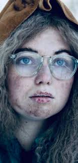 What does Misty's cracked glasses symbol mean?