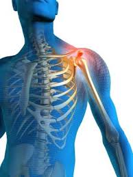 Image result for Shoulder Pain