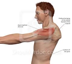 Image result for Winged Scapula