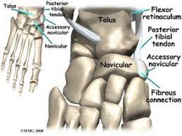 Accessory Navicular Bone Physical Therapy Anatomy Anatomy And Physiology