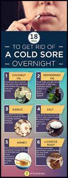 What gets rid of cold sores overnight. Pin On Keepers