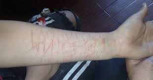 604 followers · regional website. Dos Chicos De 12 Anos Se Cortaron Los Brazos Jugando Al Free Fire Infocanuelas