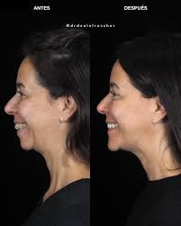 Daniel Roscher Ortognática Maxilofacial