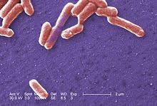 However, eating or drinking food or water contaminated with certain. Escherichia Coli Wikipedia