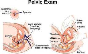 Pelvic Exam Ob Gyn Brooklyn Heights Nyc