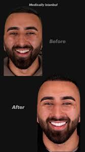 Let's welcome our new members to Dental Education Satyendra Shukla, DrMalti  Kapoor Dhir, Nesar Ahmad Khaliqy, Iqra Mughal, Anoop Saran Bhojwani, Abdur  Raheem, Nishat Naz, Srikanth Pandiyan, Verena Khaled, DrNuzhat Khan, Karu