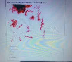 Enterobacteriaceae are a large family of different types of bacteria (germs) that commonly cause infections both in healthcare settings and in communities. Solved What Is The Correct Shape And Arrangement For The Chegg Com