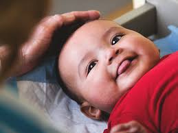 Frenectomy Procedure Recovery And Before And After Pictures