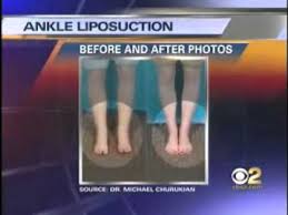 See full list on wikihow.com Ankles And Calves Youtube