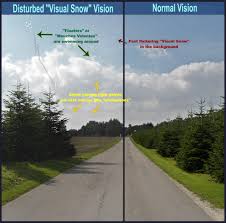 Retinal tears can best be treated with laser photocoagulation treatment in the office to fuse the retina to the back wall of the eye and prevent retinal detachment and vision loss. Floaters Vision Care At Home Ltd