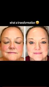 Christine Bateman, MSN, FNP-BC (@injector_tine) • Instagram photos and  videos