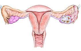 If it is diagnosed in the early stages, it can be cured with uterine cancer is treatable if diagnosed in the early stages. 5 Warning Signs Of Endometrial Cancer Every Woman Should Know Prevention