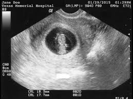 Check spelling or type a new query. Ultrasound Spoof Fake Free Apps 148apps