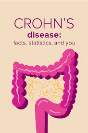 crohns disease facts statistics and you