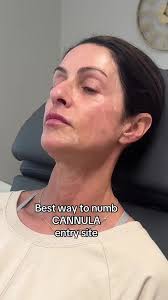 Injector tip: How to numb a cannula entry site without making your patient  flinch, 1. Add a little sodium bicarb to your lidocaine — it helps  neutralize the pH and takes the sting right out., 2. No ...