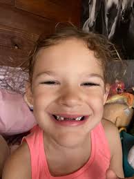 Baby teeth fall out.....🦷🦷🦷