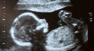 Die Bewegungen Ihres Babys Wahrend Der Schwangerschaft Babycenter