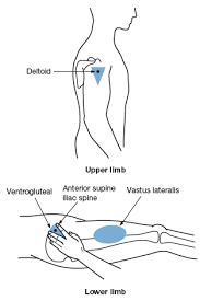 Administer Injections Litfl Ccc Procedure