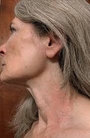 Fragrance-free community for those with sensitivities