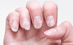 Noticing Changes in Your Nails?