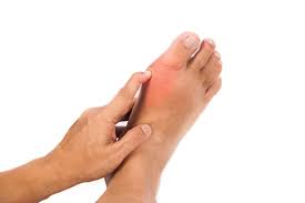 Broken big toe joint pictures. 5 Risk Factors For Developing Big Toe Joint Arthritis