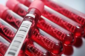 Resultado de imagen para prueba de sangre