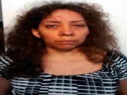 Madre asfixia a su hija por haberla mordido; padecía parálisis cerebral