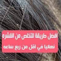 افضل طريقة للتخلص من القشره نهائيا في اقل من ربع ساعه in 2021 herbs